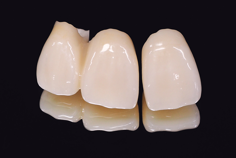 ジルコニアダイヤクラウン