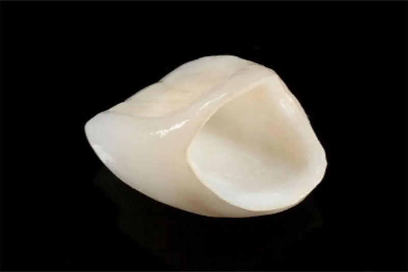 ファインセラミッククラウン