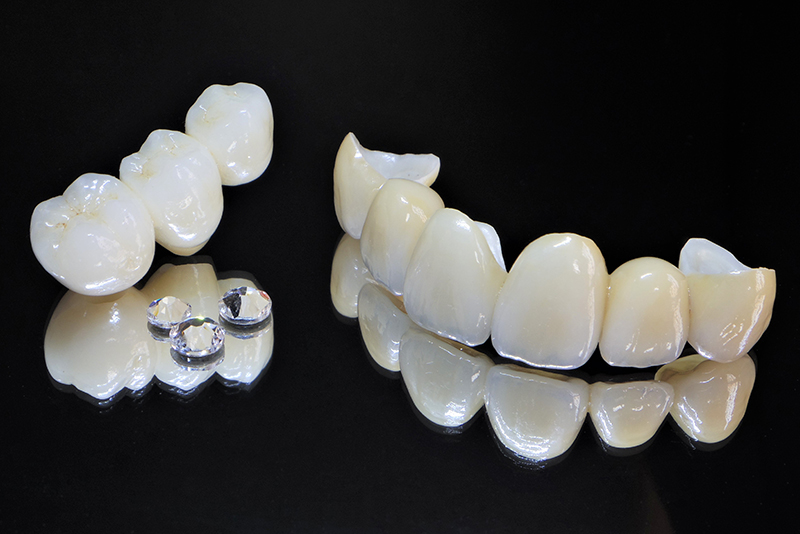 セラミックダイヤクラウン