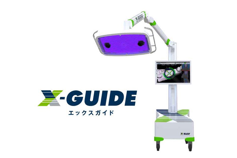 Xガイド（インプラントガイドシステム）