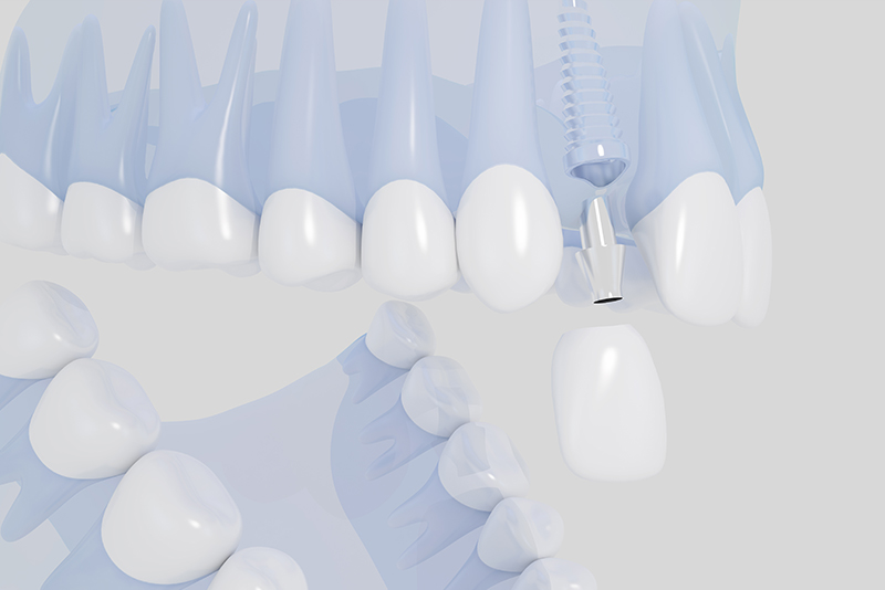 安心して治療を受けていただくための保証制度