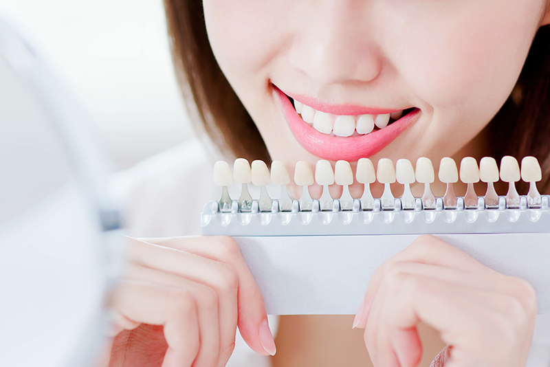 歯を削ることなく色調の改善をめざせる