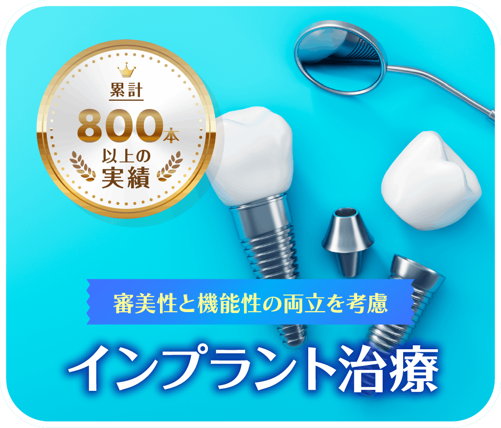 インプラント治療