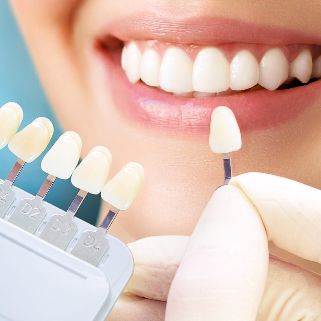 ホワイトニング